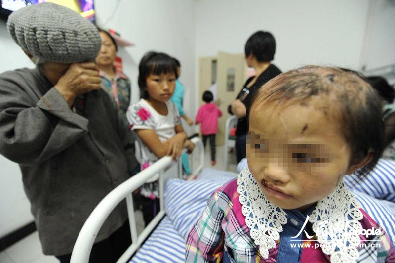 贵州金沙11岁女童惨遭亲生父亲酷刑 饱受虐